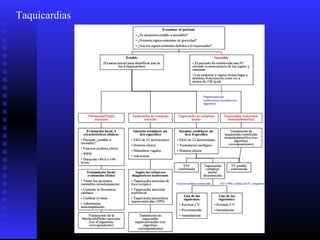 Taquicardias
 