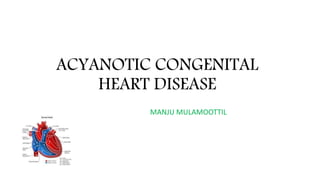 ACYANOTIC CONGENITAL
HEART DISEASE
MANJU MULAMOOTTIL
 
