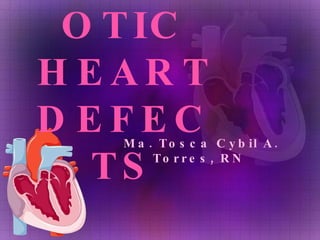 ACYANOTIC HEART DEFECTS Ma. Tosca Cybil A. Torres, RN  