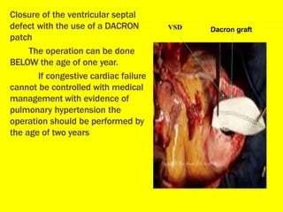 Closure of the ventricular septal
defect with the use of a DACRON
patch
The operation can be done
BELOW the age of one year.
If congestive cardiac failure
cannot be controlled with medical
management with evidence of
pulmonary hypertension the
operation should be performed by
the age of two years
Dacron graft
VSD
 