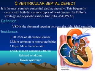 Vsd Incedence Acyanotic heart diseases | PPT