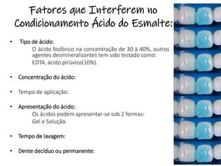 Fatores que Interferem no
Condicionamento Ácido do Esmalte:
• Tipo de ácido:
O ácido fosfórico na concentração de 30 à 40%, outros
agentes desmineralizantes tem sido testado como:
EDTA, ácido pirúvico(10%).
• Concentração do ácido:
• Tempo de aplicação:
• Apresentação do ácido:
Os ácidos podem apresentar-se sob 2 formas:
Gel e Solução.
• Tempo de lavagem:
• Dente decíduo ou permanente:
 