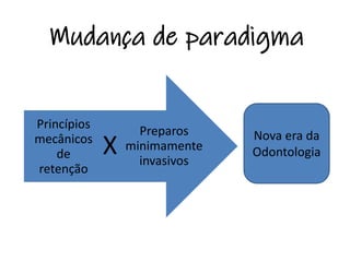 Mudança de paradigma
Preparos
minimamente
invasivos
X
Princípios
mecânicos
de
retenção
Nova era da
Odontologia
 