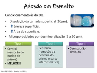 Adesão em Esmalte
Condicionamento ácido 30s:
• Dissolução da camada superficial (10µm).
• Energia superficial.
• Área de superfície.
• Microporosidades por desmineralização (5 a 50 µm).
• Central
(remoção do
núcleo do
prisma)
• MELHOR!!
• Periférica
(remoção da
periferia do
prisma e parte
interprismática)
• Sem padrão
definido
Tipo IITipo I Tipo III
Livro GBPD 2005 e Baratieri et al 2013.
 