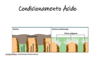 Condicionamento Ácido
 