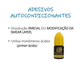 ADESIVOS
AUTOCONDICIONANTES
• Dissolução PARCIAL OU MODIFICAÇÃO DA
SMEAR LAYER;
• Utiliza monômeros ácidos
(primer ácido)
 