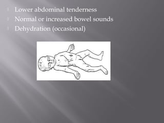    Lower abdominal tenderness
   Normal or increased bowel sounds
   Dehydration (occasional)
 