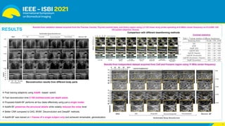 Switchable Deep Beamformer for Ultrasound Imaging Using ADAIN | PDF