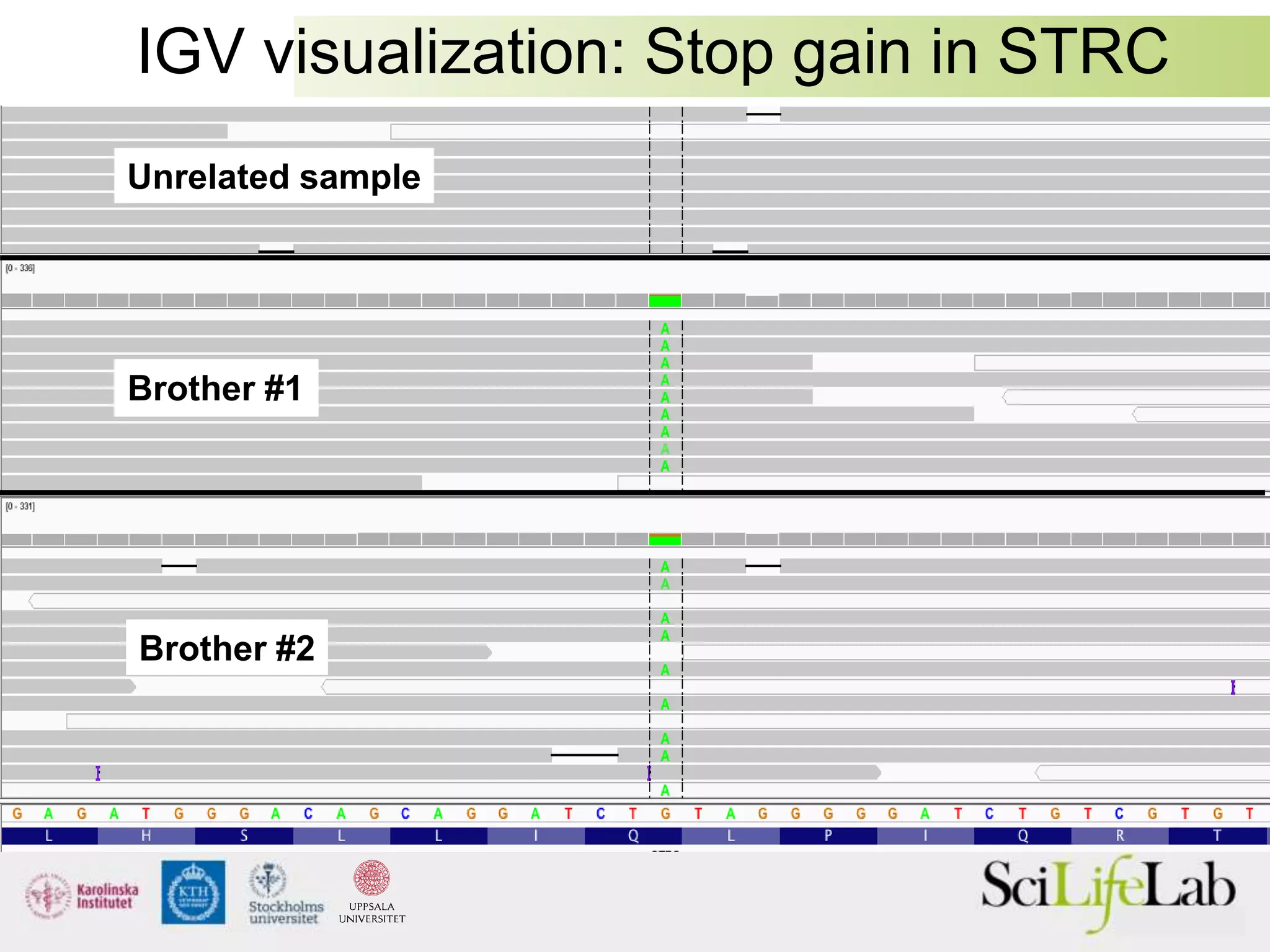 Brother #1
Brother #2
Unrelated sample
IGV visualization: Stop gain in STRC
 