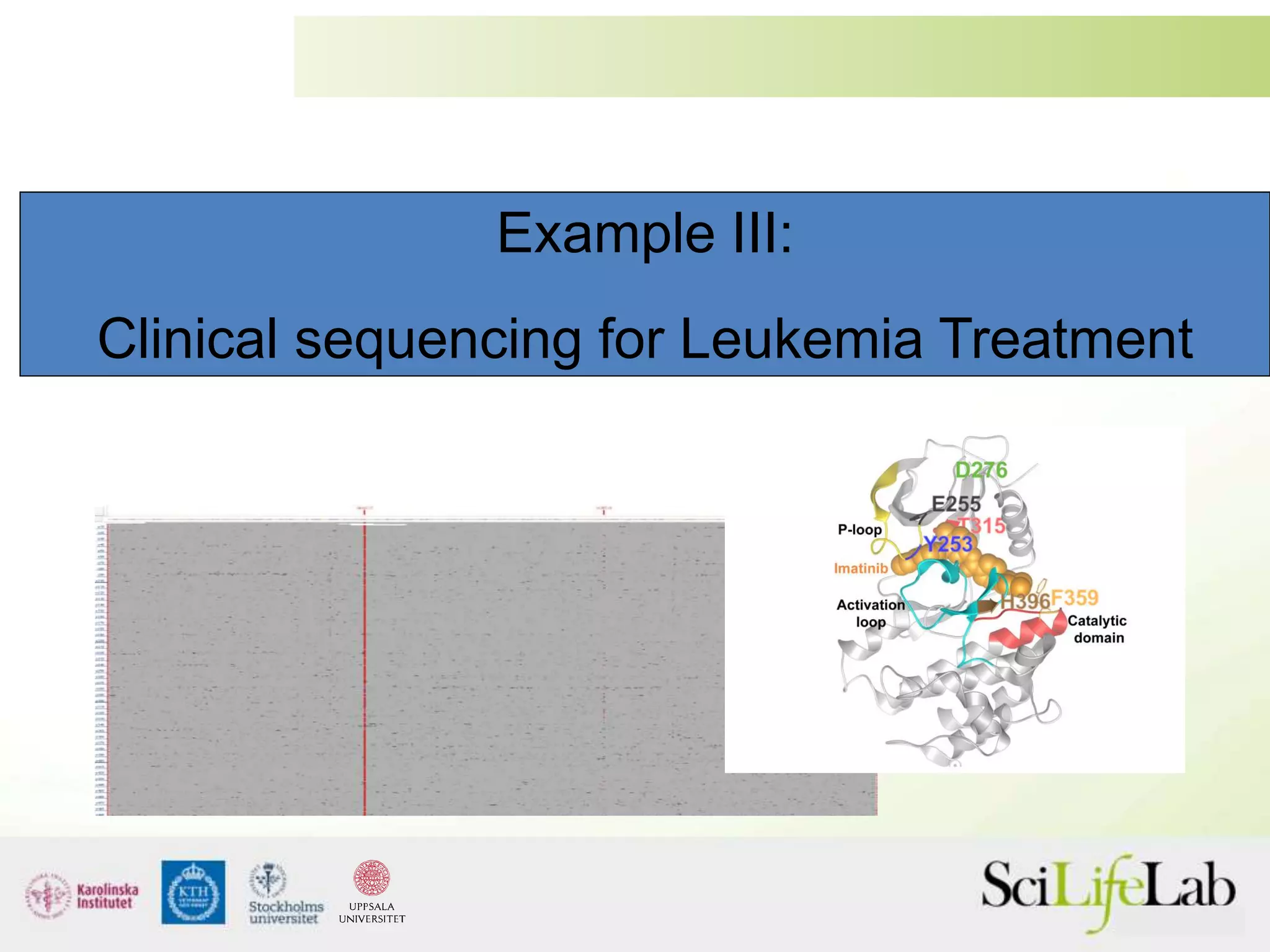 Example III:
Clinical sequencing for Leukemia Treatment
 