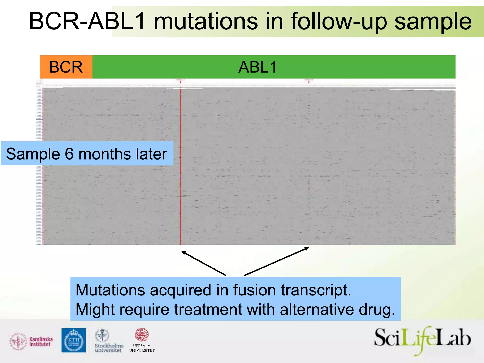 BCR-ABL1 mutations in follow-up sample
Sample 6 months later
Mutations acquired in fusion transcript.
Might require treatment with alternative drug.
BCR ABL1
 