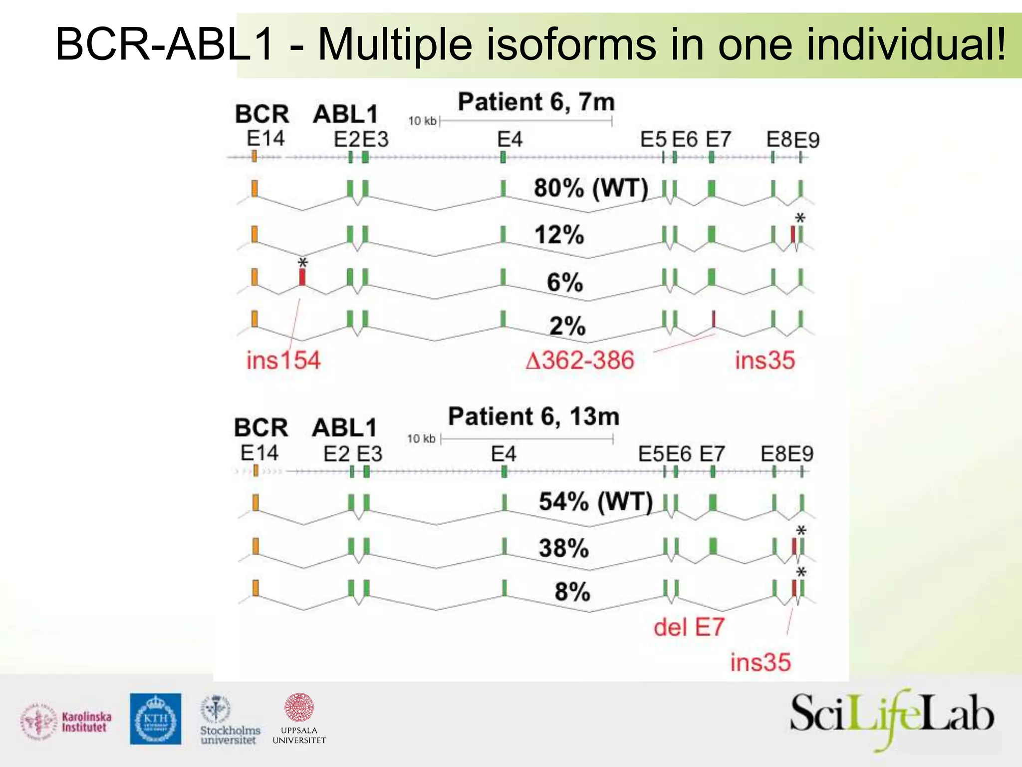BCR-ABL1 - Multiple isoforms in one individual!
 