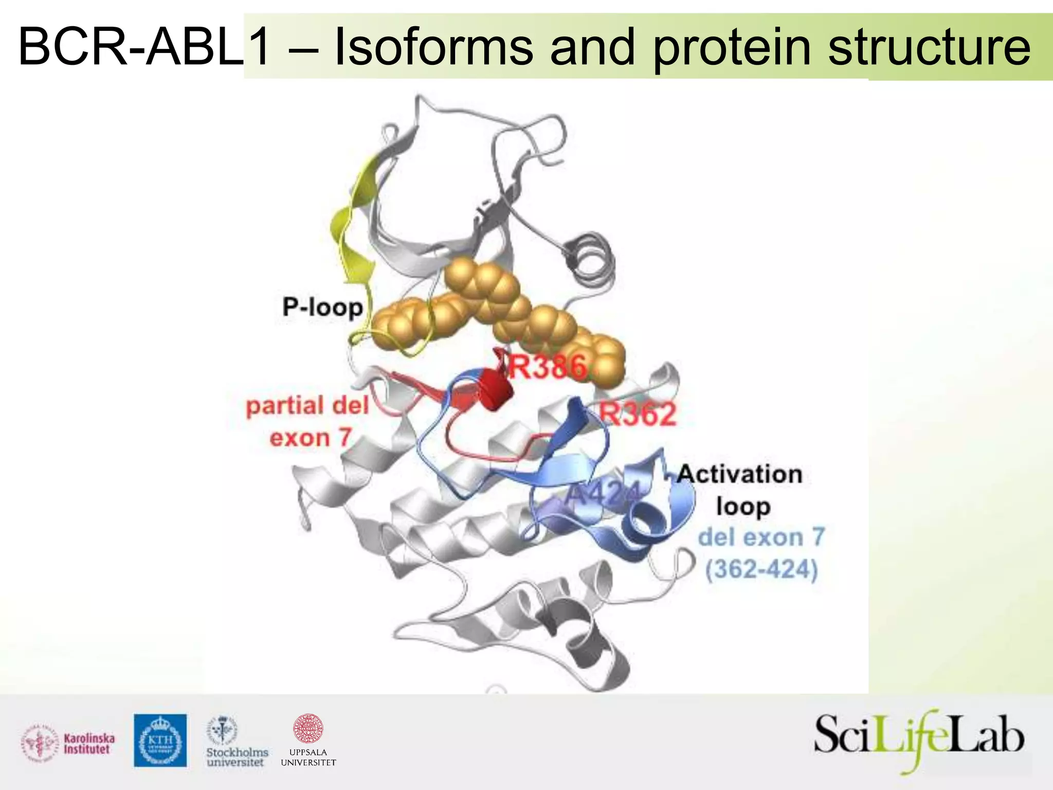 BCR-ABL1 – Isoforms and protein structure
 