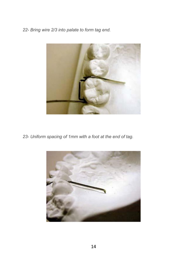 Adams clasp practice