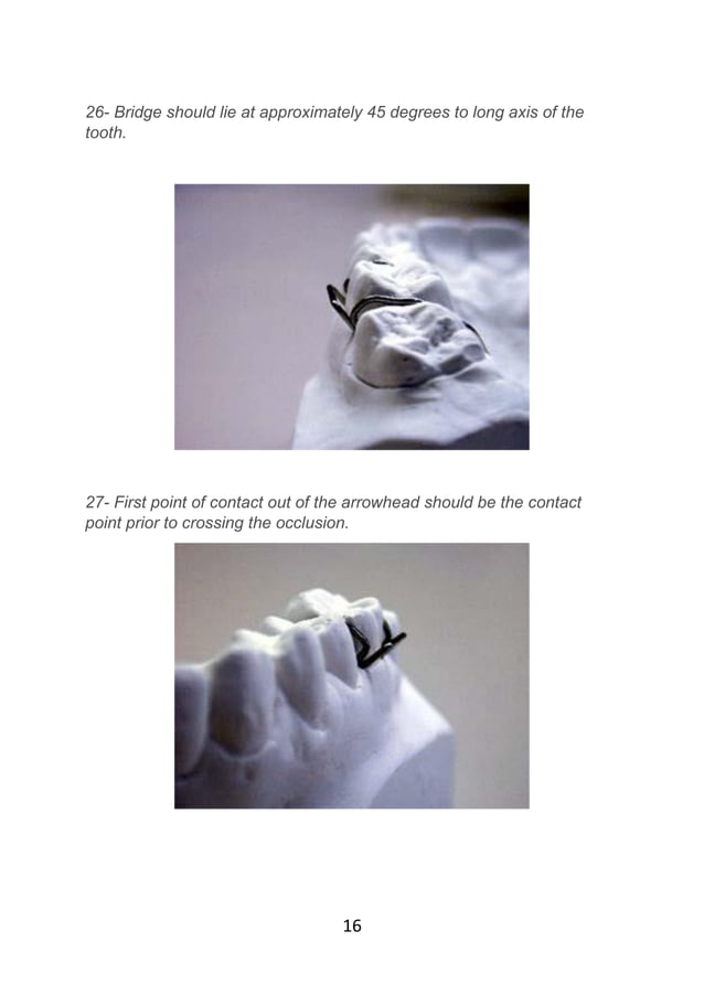 Adams clasp practice