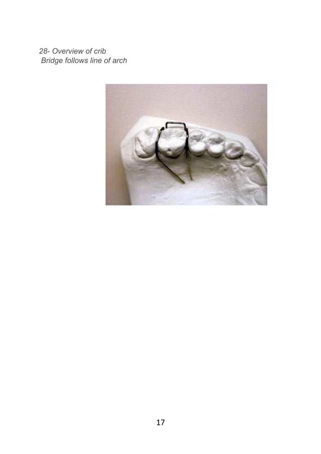 Adams clasp practice