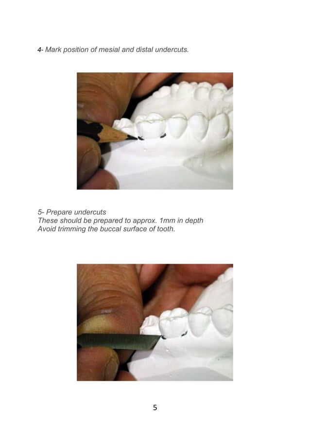 Adams clasp practice