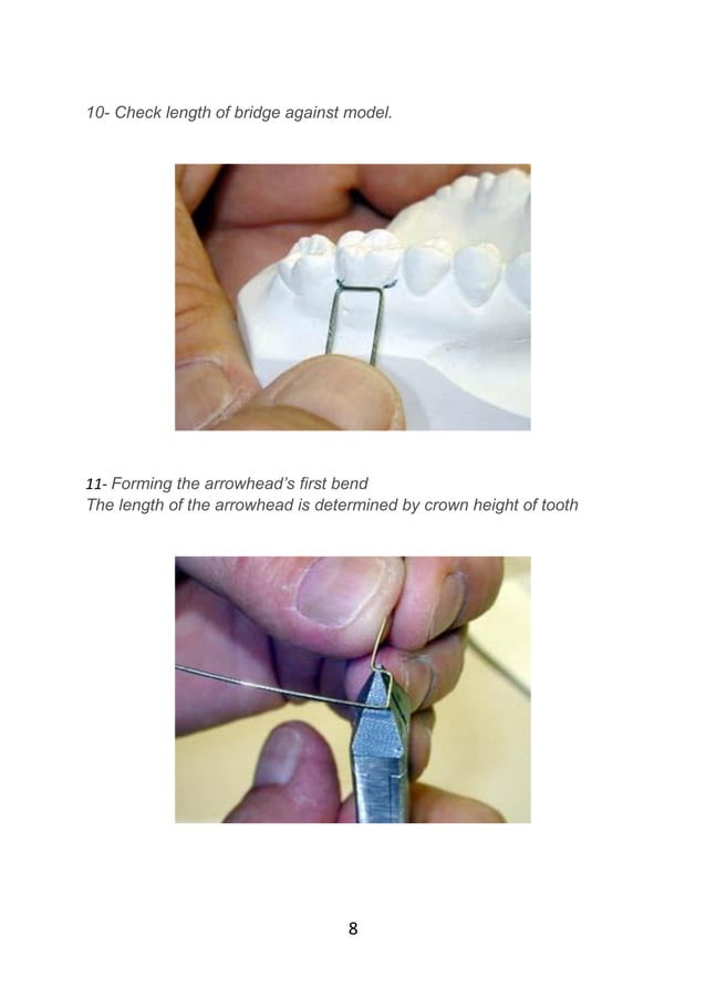 Adams clasp practice