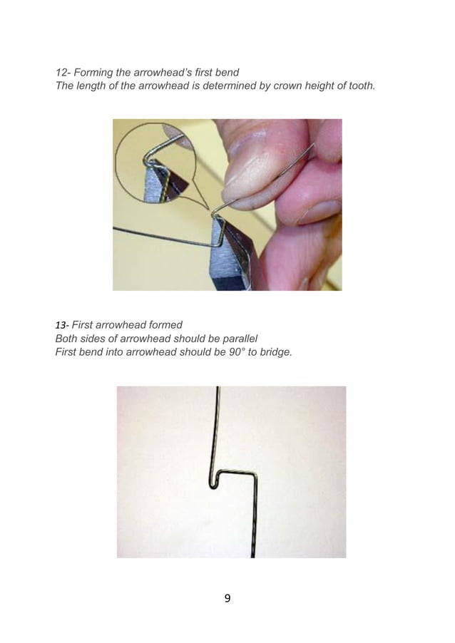 Adams clasp practice