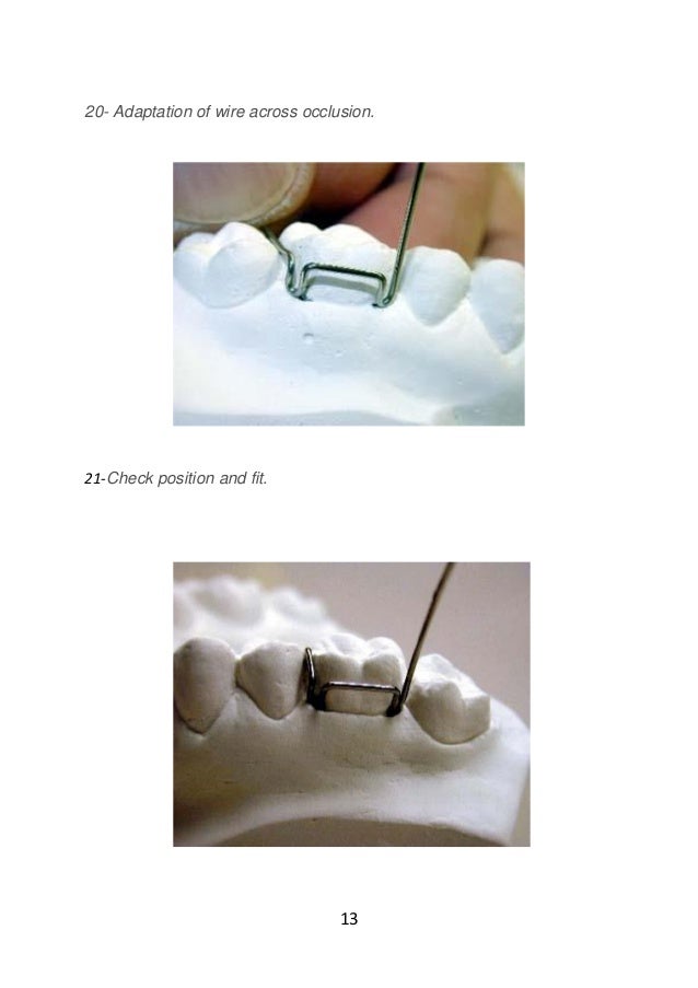 Adams clasp practice