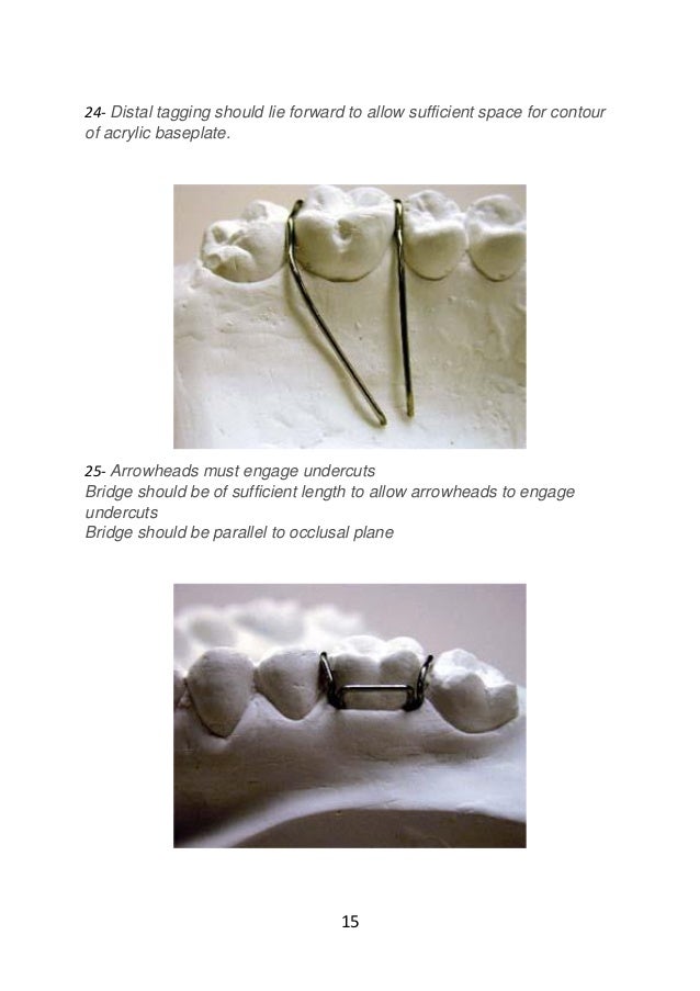 Adams clasp practice