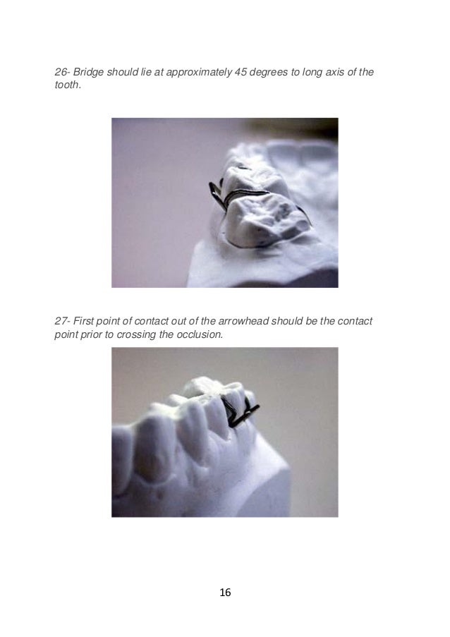 Adams clasp practice