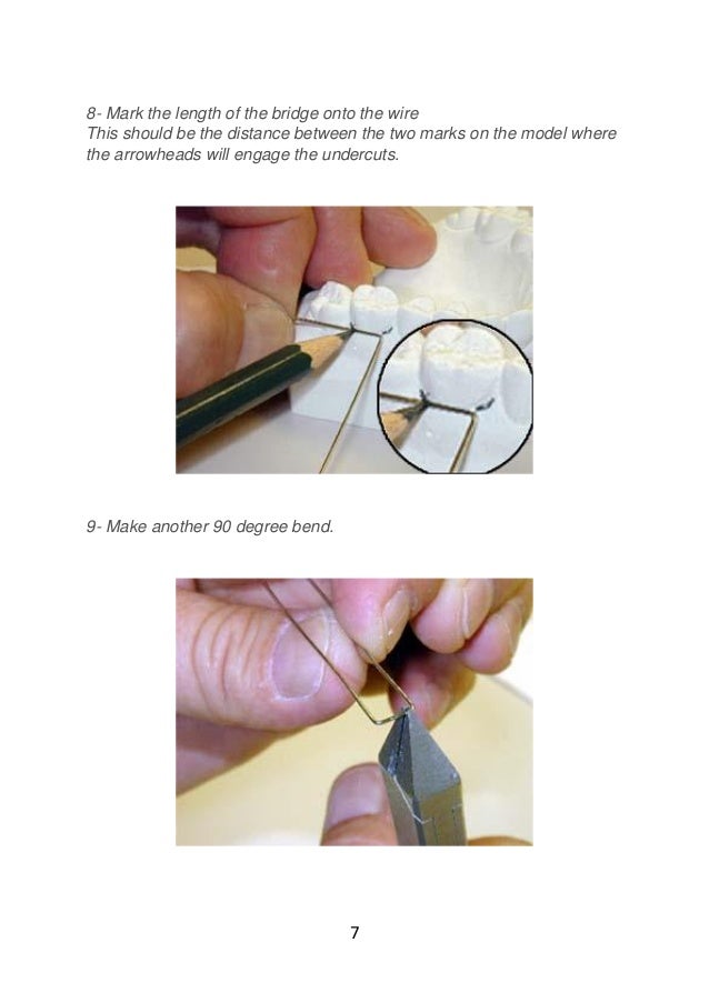 Adams clasp practice