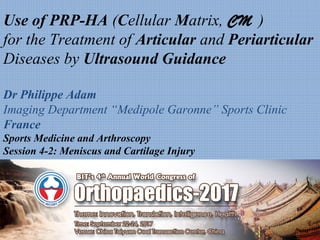 Use of PRP-HA (Cellular Matrix, CM )
for the Treatment of Articular and Periarticular
Diseases by Ultrasound Guidance
Dr Philippe Adam
Imaging Department “Medipole Garonne” Sports Clinic
France
Sports Medicine and Arthroscopy
Session 4-2: Meniscus and Cartilage Injury
 