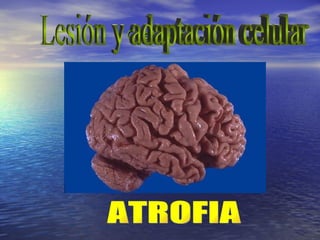Clasificación Lesión y adaptación celular ATROFIA 