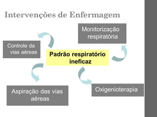 Intervenções de Enfermagem
 