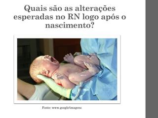 Quais são as alterações
esperadas no RN logo após o
nascimento?
Fonte: www.google/imagens
 