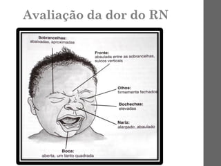 Avaliação da dor do RN
 
