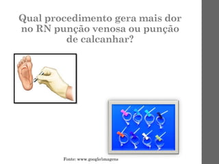 Qual procedimento gera mais dor
no RN punção venosa ou punção
de calcanhar?
Fonte: www.google/imagens
 