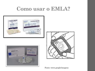 Como usar o EMLA?
Fonte: www.google/imagens
 