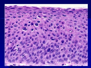 Anatomía patológica, tema: Adaptación celular