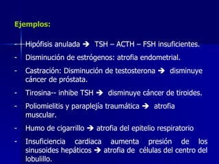 Ejemplos:
- Hipófisis anulada  TSH – ACTH – FSH insuficientes.
- Disminución de estrógenos: atrofia endometrial.
- Castración: Disminución de testosterona  disminuye
cáncer de próstata.
- Tirosina-- inhibe TSH  disminuye cáncer de tiroides.
- Poliomielitis y paraplejía traumática  atrofia
muscular.
- Humo de cigarrillo  atrofia del epitelio respiratorio
- Insuficiencia cardiaca aumenta presión de los
sinusoides hepáticos  atrofia de células del centro del
lobulillo.
 