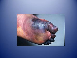 Lesión CelularEs producto cuando las células son sometidas a un estrés que no son capaces de adaptarse o cuando son expuestas a agentes dañinos.