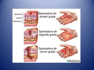 Lesión CelularCausas:Privación de Oxigeno: Hipoxia y Isquemia