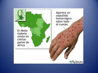 Agentes Químicos: Venenos y sustancias toxicas