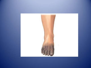  Es también un aumento de Eosinofilia