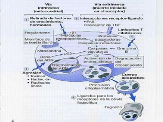 Lesión CelularNecrosis Caseosa: Es muy frecuente en infecciones de tipo tuberculosas