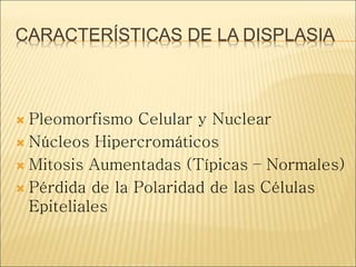 CARACTERÍSTICAS DE LA DISPLASIA
 Pleomorfismo Celular y Nuclear
 Núcleos Hipercromáticos
 Mitosis Aumentadas (Típicas – Normales)
 Pérdida de la Polaridad de las Células
Epiteliales
 