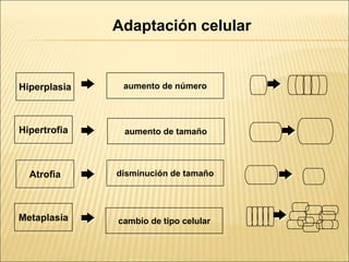 Atrofia disminución de tamaño
Hipertrofia aumento de tamaño
Hiperplasia aumento de número
Metaplasia cambio de tipo celular
Adaptación celular
 