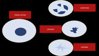 cariorrexis
cariolisis
picnosis
Célula normal
 
