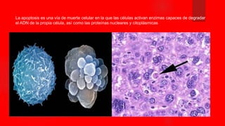La apoptosis es una vía de muerte celular en la que las células activan enzimas capaces de degradar
el ADN de la propia célula, así como las proteínas nucleares y citoplásmicas
 