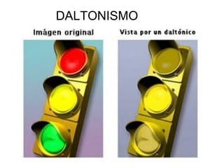 DALTONISMO
 