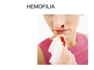 HEMOFILIA
 