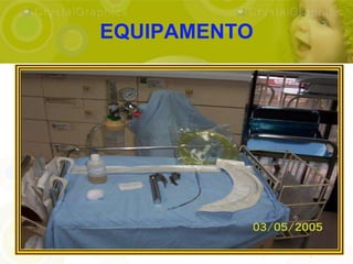 EQUIPAMENTO
 
