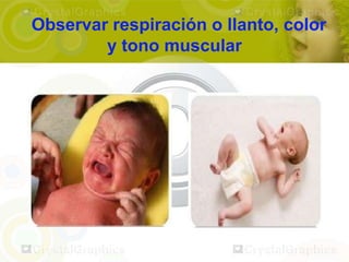 Observar respiración o llanto, color
        y tono muscular
 