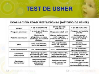 TEST DE USHER
 